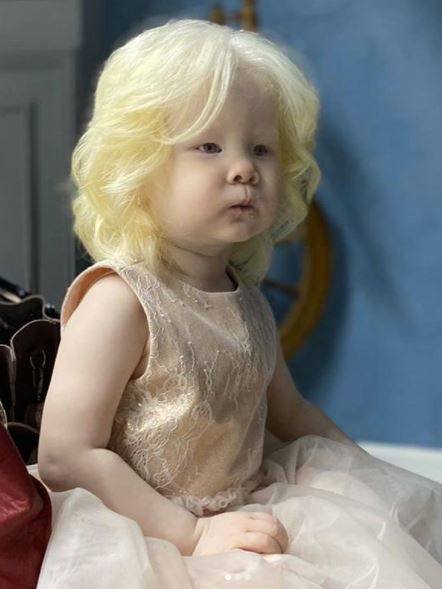 Albino sisters born 12 years apart become modeling sensations