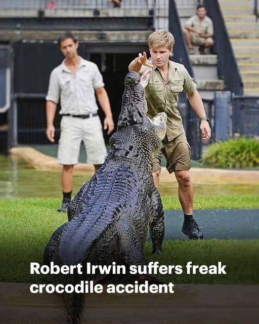 Robert Irwin gets ‘head smashed into tree’ during freak accident