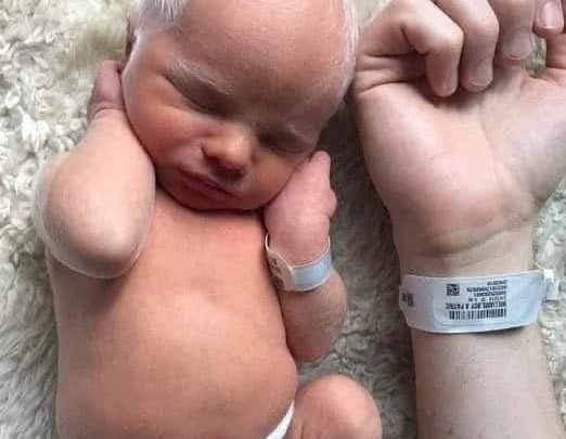 P3. Baby mocked for having white hair – years later, he looks perfectly happy and healthy