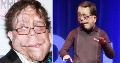 The incredible story of actor Adam Pearson: He’s an inspiration to millions